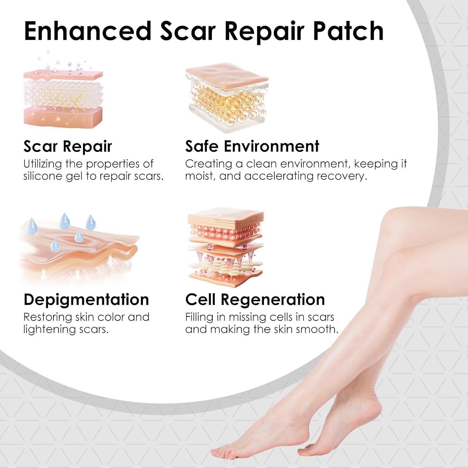 Silicone Scar Sheets,Silicone Scar Tape for Removal Treatment,Medical Grade Scar Tape for Surgical Scars,C-Section,Tummy Tuck,Scar Removal Away(1.6" x 60" Roll - 1.5M)