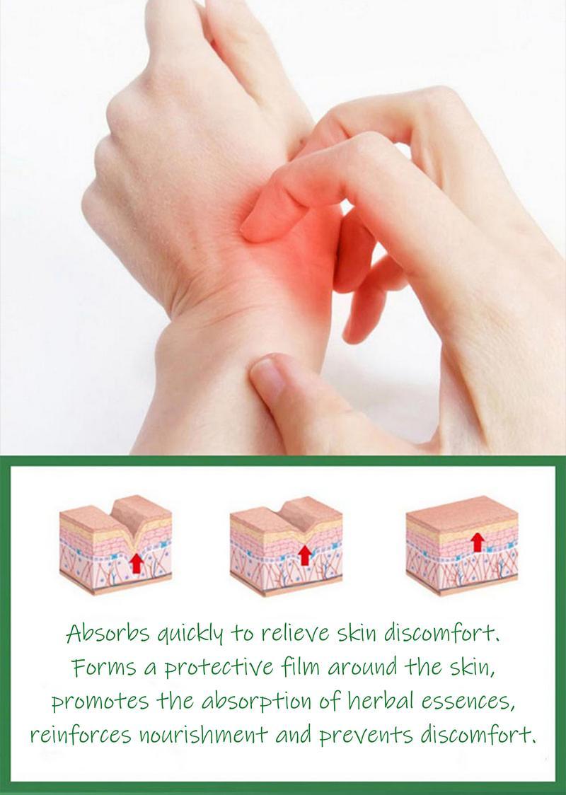 Umex All-Natural Plant-Based Herbal Relief Cream – Soothes Eczema, Psoriasis, Dry & Sensitive Skin | Ancient Botanical Formula for Whole Family Moisturizing Daily