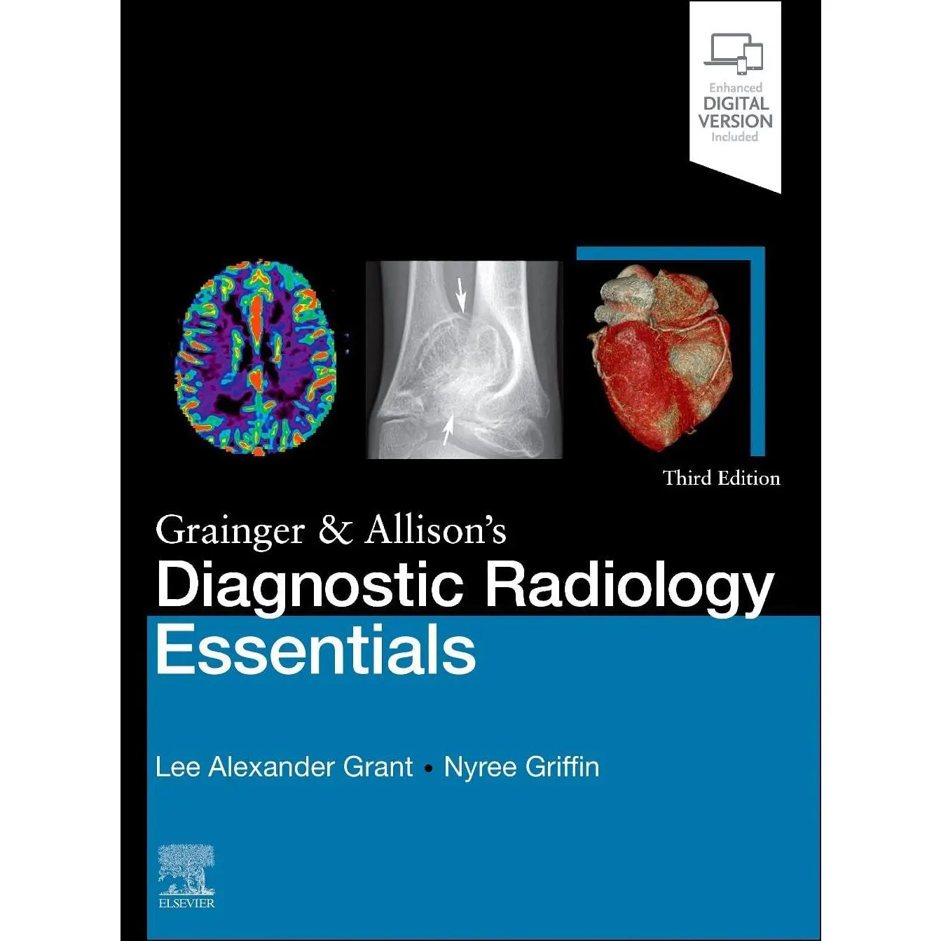 Grainger & Allison's Diagnostic Radiology Essentials - 3rd Edition by Lee A Grant & Nyree Griffin (Hardcover)