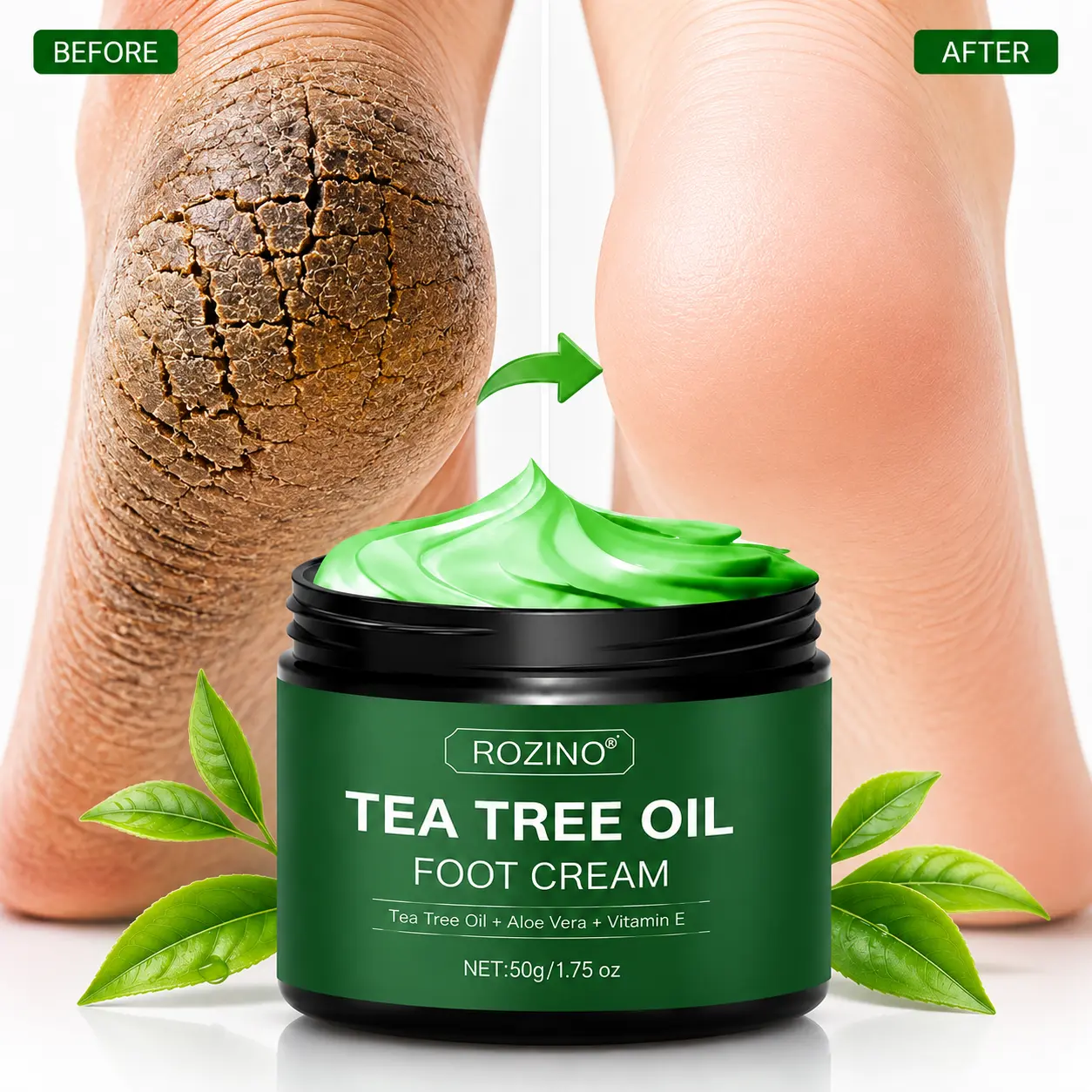 ROZINO Tea Tree Oil Foot Cream with Aloe Vera (50g) - Daily Lightweight Peppermint Cream for Intensive Moisture, Dry Cracked Heels, Rough Feet