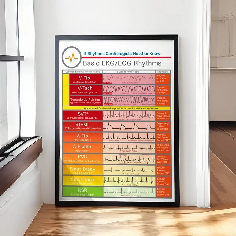 [UNFRAMED POSTER] Basic EKG ECG Rhythms Poster – Medical Knowledge Wall Art – Nursing School Decor – Heart Rhythm Chart Canvas – EMT Study Print