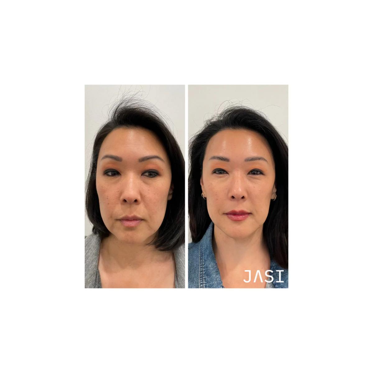 Recovery Serum - Botanical Soothing Serum for Irritated Skin | JASI Skin + Wellness Med Spa