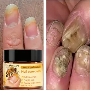 Nail Care Cream, Moisturizing, Strengthening, Hardening Nails, Ideal for Wear-Prone, Dry, Rough Nails, Gentle and Quick-Drying