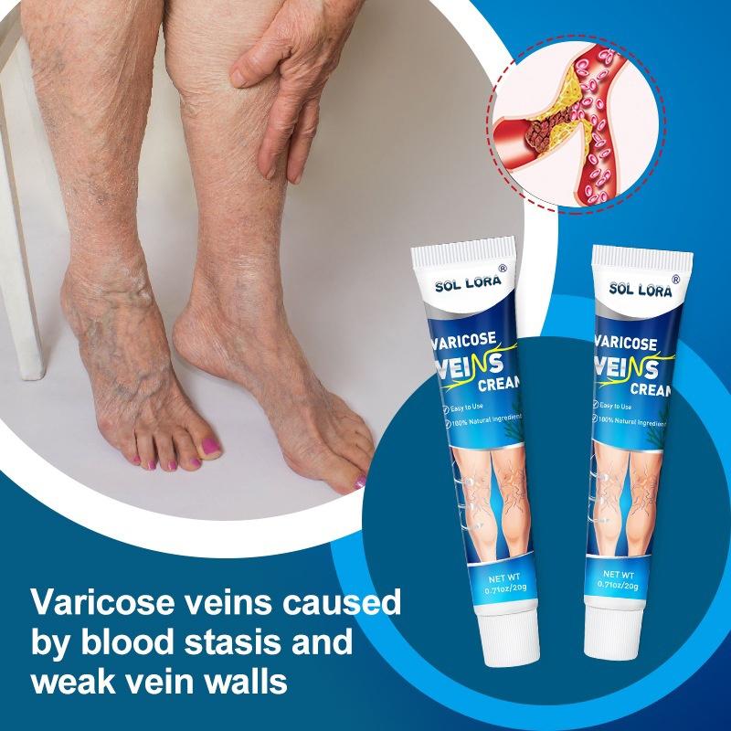 SOL LORA Varicose Veins Cream for Varicose Veins Relief of Bulging Blood Vessels in Legs - Hydrating Moisturizer for Smoother Skin & Improved Circulation
