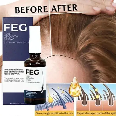 Feg Plus Hair Growth Spray Men - TikTok Shop