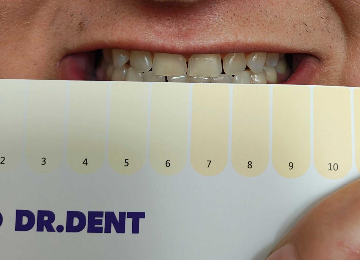 Item: 42 strips (21 sessions)