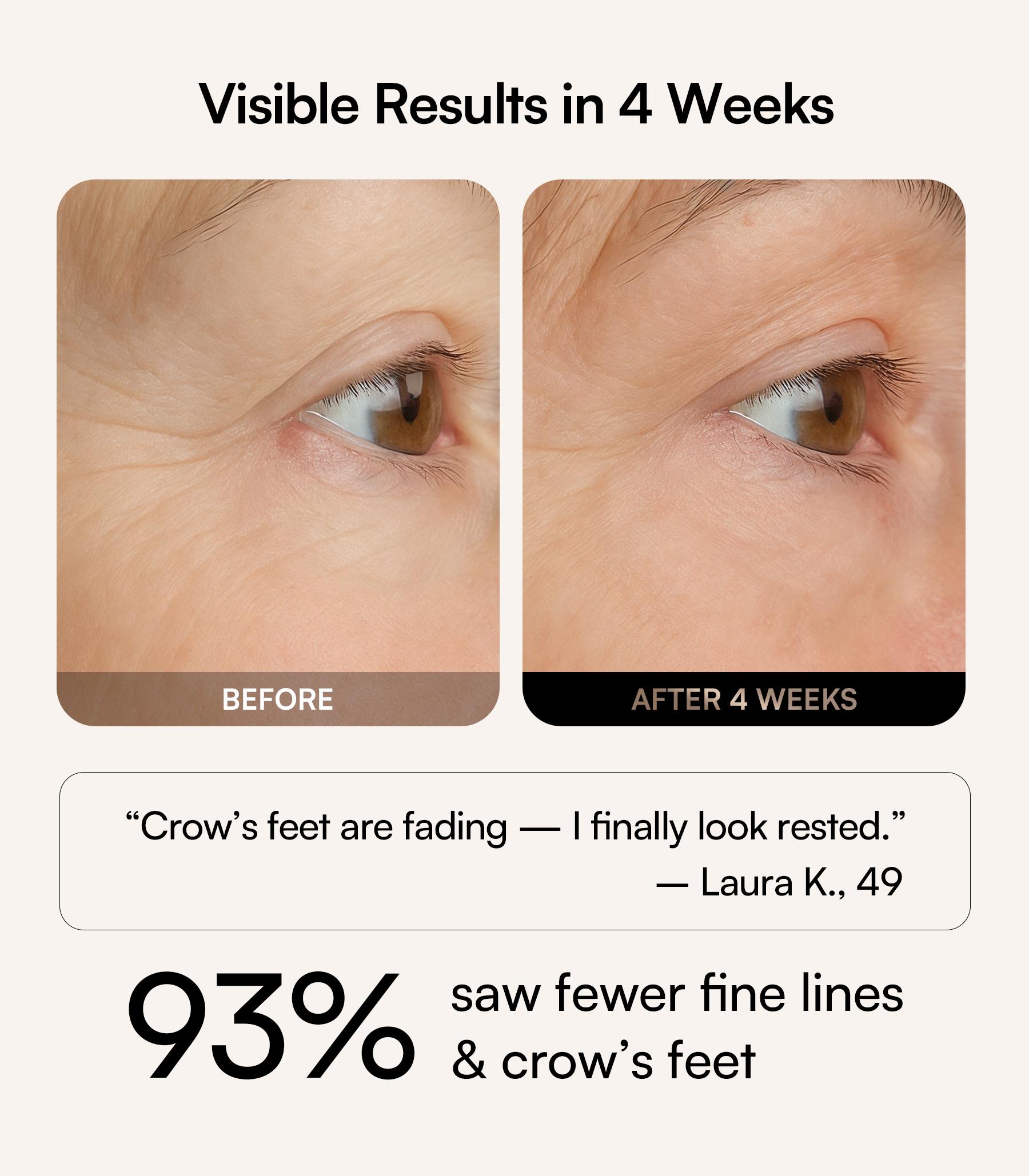 INIA GLOW Red Light Therapy Eye Mask with 96 High-Density LEDs & Cryotherapy Cooling, LED Eye Mask Skincare for Wrinkles, Dark Circles & Puffiness, FDA-Cleared, Portable and Rechargeable, 2-Year Warranty