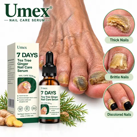 Umex Extra Strength Toenail Fungus Treatment - 2 Bottles, Natural Antifungal Solution with Triple-Action Herbal Blend, Healthy Nail Growth Oil, Adults' Nail Care, Orchid Nourish, Smooth Edges, Manicure Support