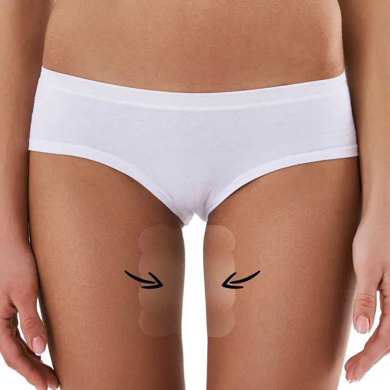 Skinnies Instant Inner Thigh Lifting & Shaping Tape (6.5"x5", 5-Pairs/10 Patches) – Invisible Body Contour Strips, Sweatproof, Hypoallergenic, Latex-Free | Smooth Silhouette Under Dresses & Skirts | Up to Size 14