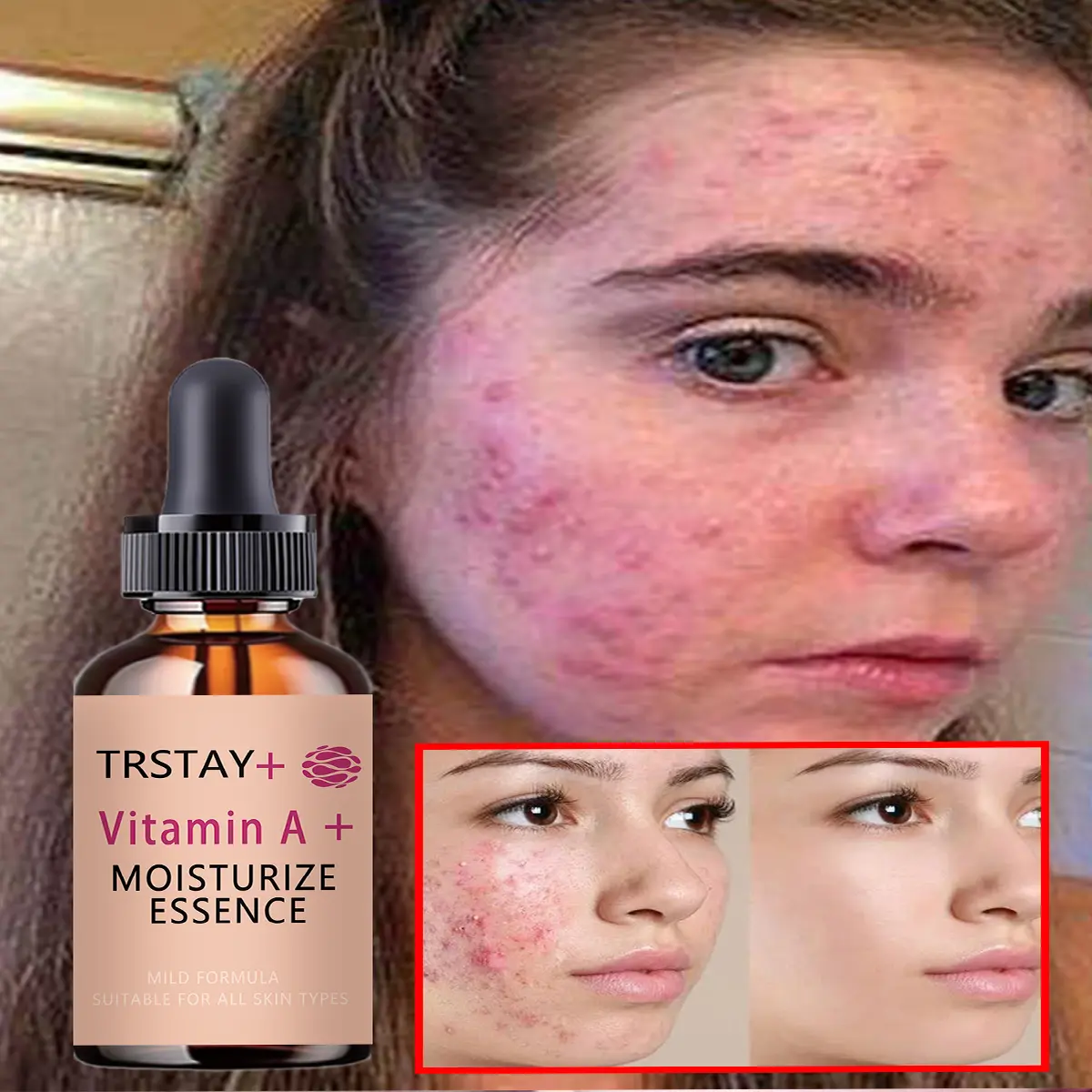 Facial Moisturizing Serum – Enriched with Vitamin A; offers a silky, lightweight, and non-greasy texture tha Hydrator Serum