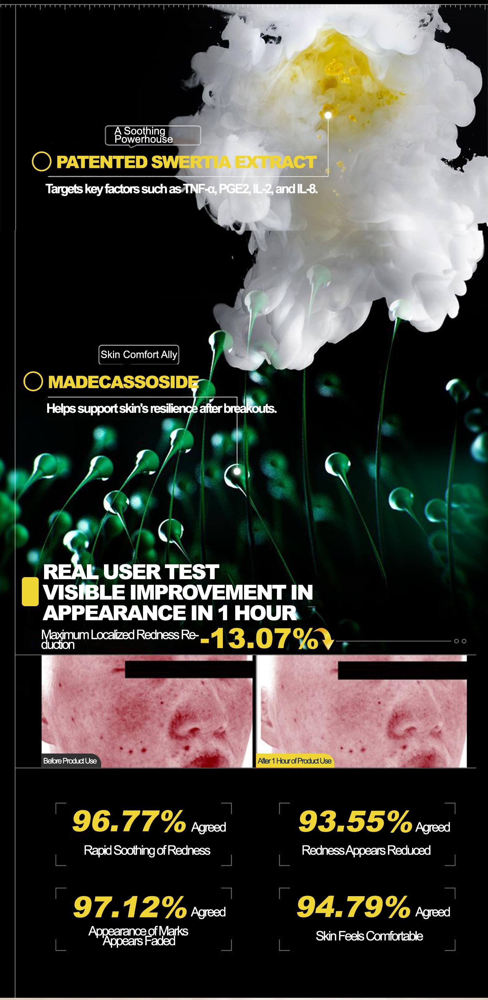 DR.MOPICK 24H Acne Care Essence, Clears Blemishes & Refreshes Skin By Day, Soothes & Prevents Breakouts By Night