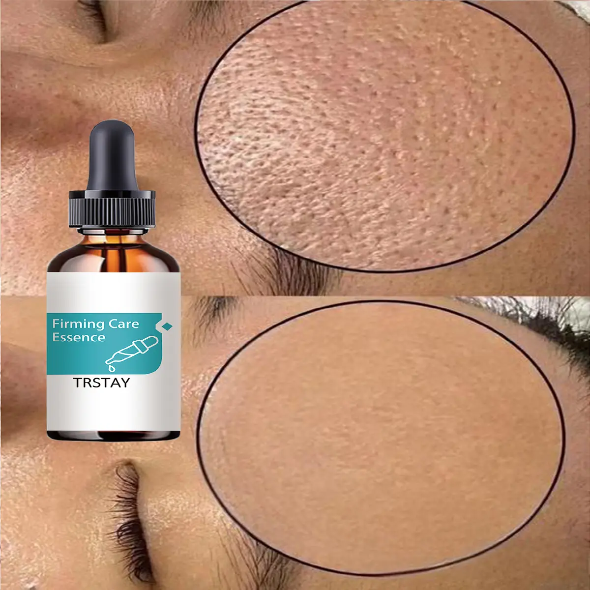Facial Hydrating Serum – Specially formulated for dry skin; rapidly replenishes moisture, leaving the skin silky-smooth and refined. Suitable for daily facial skincare. Hydrator Serum