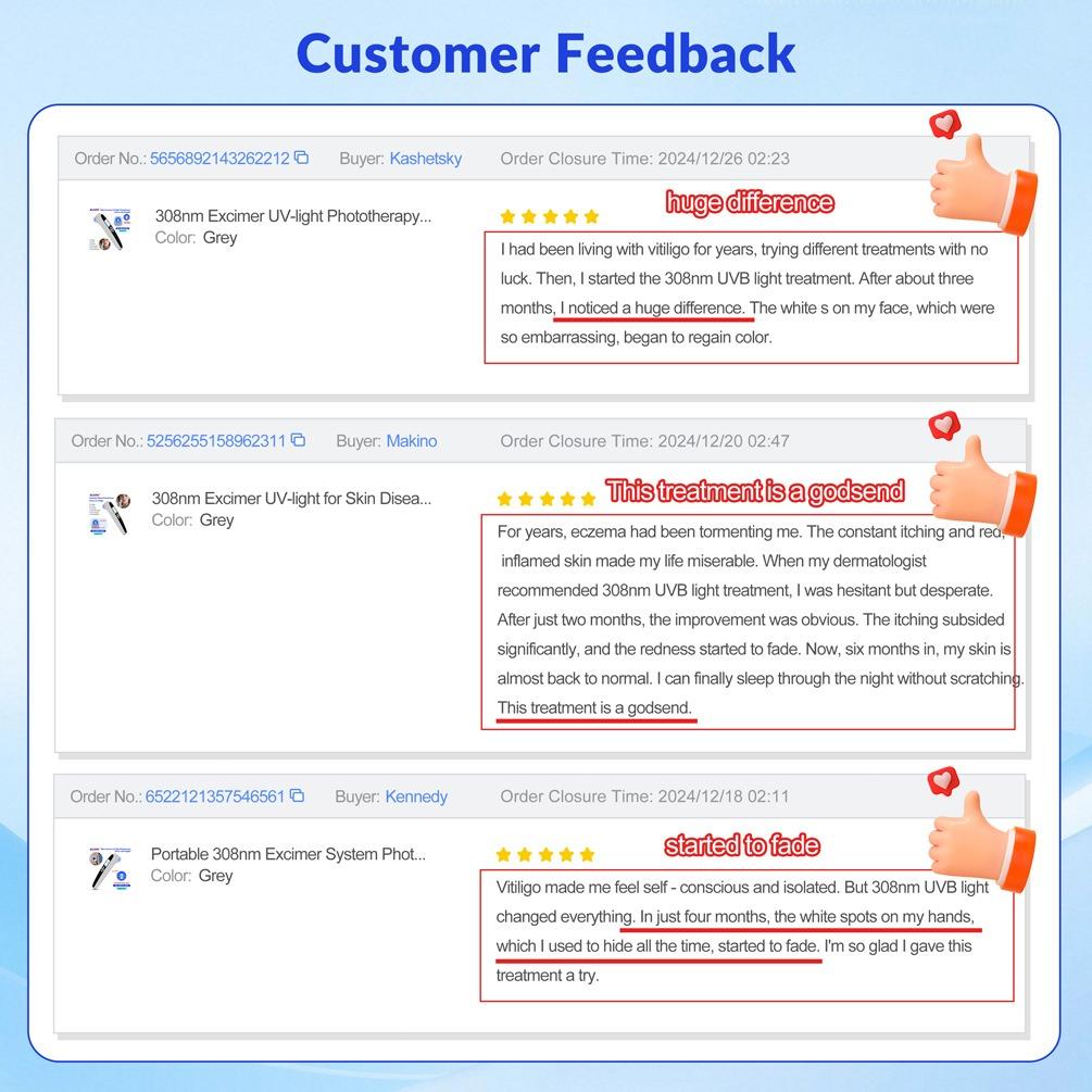 ZJZK 9 Diodes 308nm UVB Excimer Phototherapy Device, 55mW/cm² High Energy Density, Handheld Blue Light Skin Treatment, Targeted Therapy for Vitiligo, Psoriasis, Eczema, Atopic Dermatitis, Portable Home Use for Skin Disorders