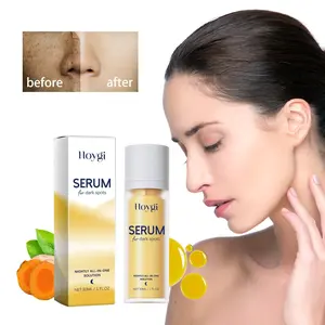 Hoygi Facial Brightening Serum 30ML, Contains Niacinamide and Turmeric Extracts, Moisturizing Hydrating Lightweight Face Lotion, Fades Spots and Acne Marks