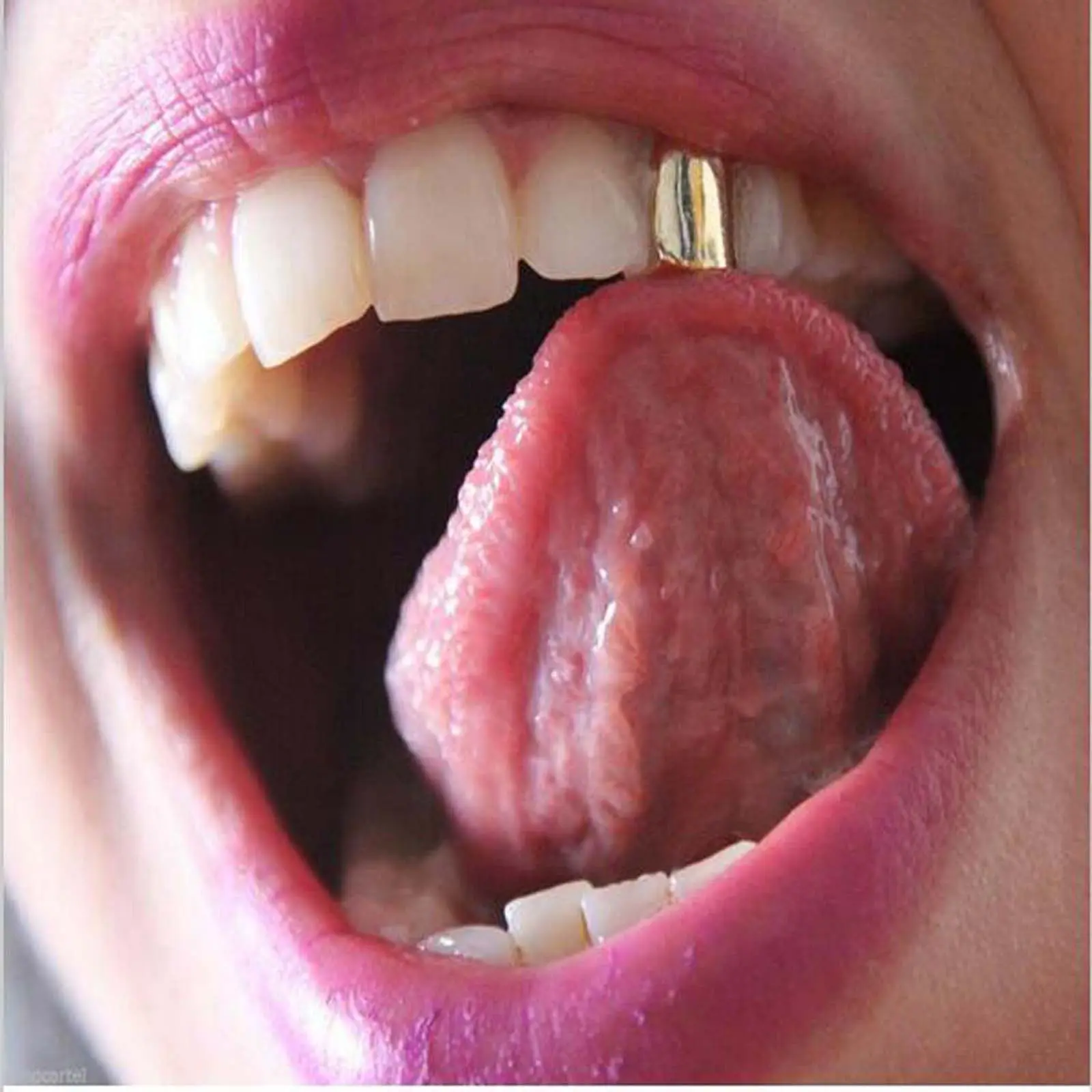 HIPHOP golden braces single tooth cool accessories daily versatile y2k party jewelry gift