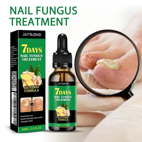 JAYSUING Ginger Nail Treatment – Extra Strength Nourishing Formula with Vitamin E & Plant Extracts for Healthy-Looking Nails, 1 Fl Oz
