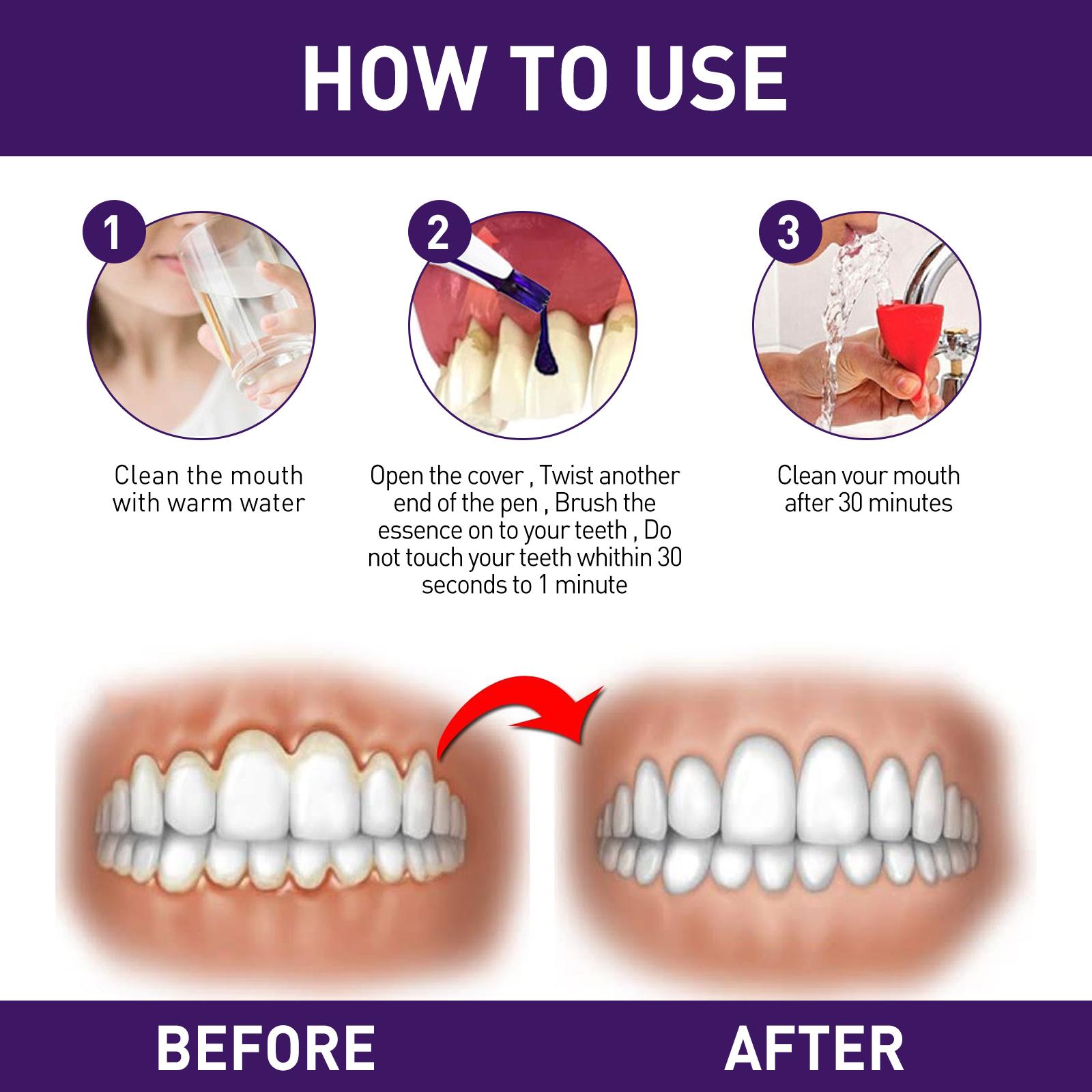 Teeth Cleansing Pen Oral Stain Removal Teeth Polishing Gum Care Liquid Pen