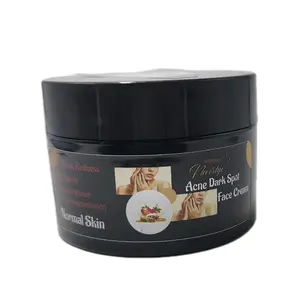 Neverlye Facial 1.oz Acne Cream for Normal Skin - Reduces Redness & Dark Spots - Effective Treatment for Acne Prone Skin