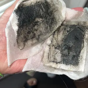 20PCS Natural Herbal Foot Detox Patches -GingerBamboo Deep Cleansing Pads for Stress Relief,Toxin Removal, Better Sleep & Wellness FitnessTreatment Healthcare Solution TherapeuticHealthy Therapy,detox foor pads