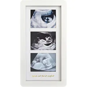 Love at First Sight Ultrasound Picture Frames,Triple Ultrasound Picture Frames,Sonogram Picture Frame 3 Photos, Announcements (White)