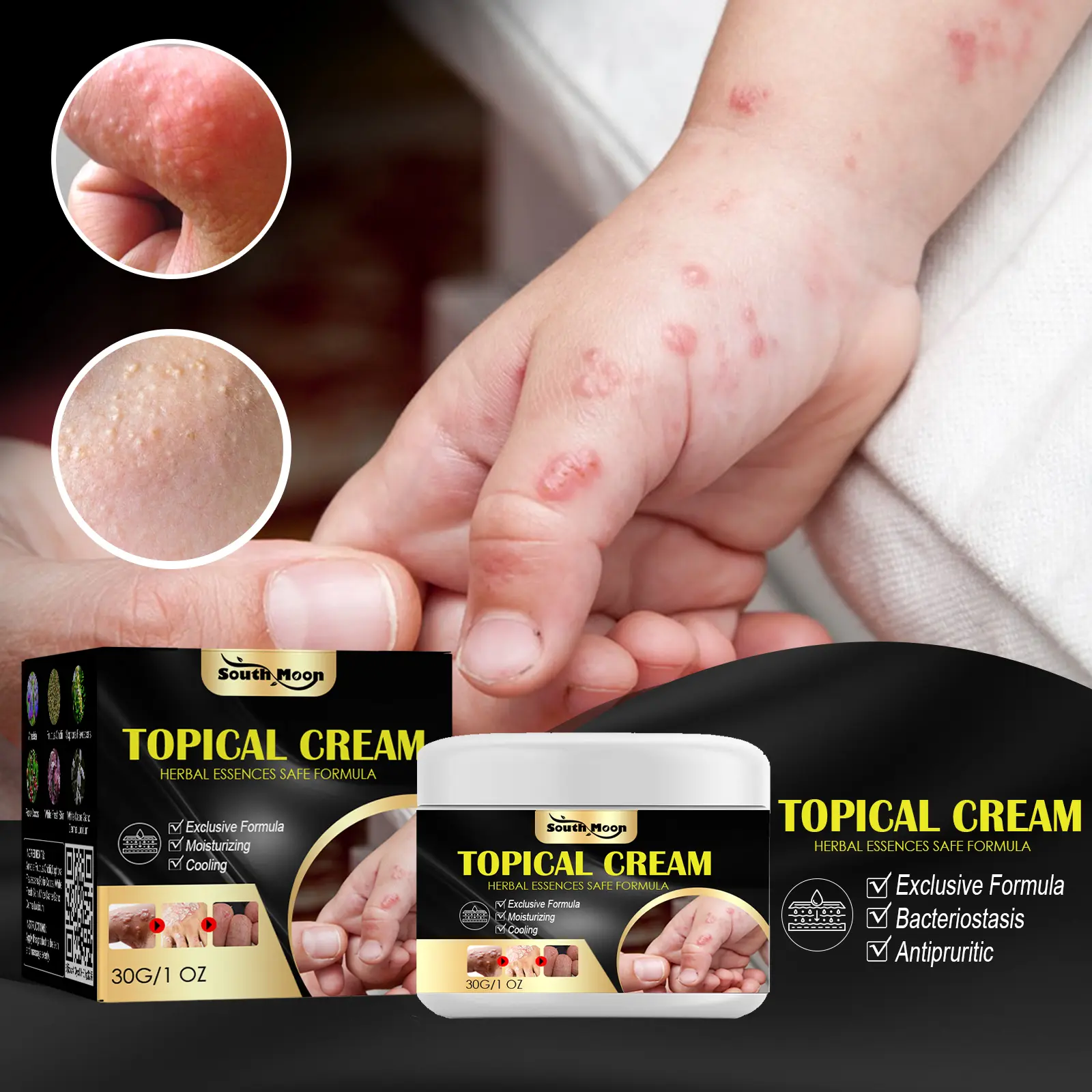 Therapeutic Hand and Foot Itch Relief Balm with Sophora Calm Extract - Body Moisturizer for Skin Dryness, Mosquito Bite Repair