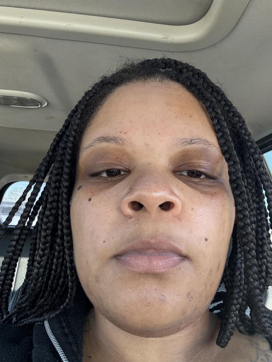 Item: Lemon Turmeric & Kojic Acid