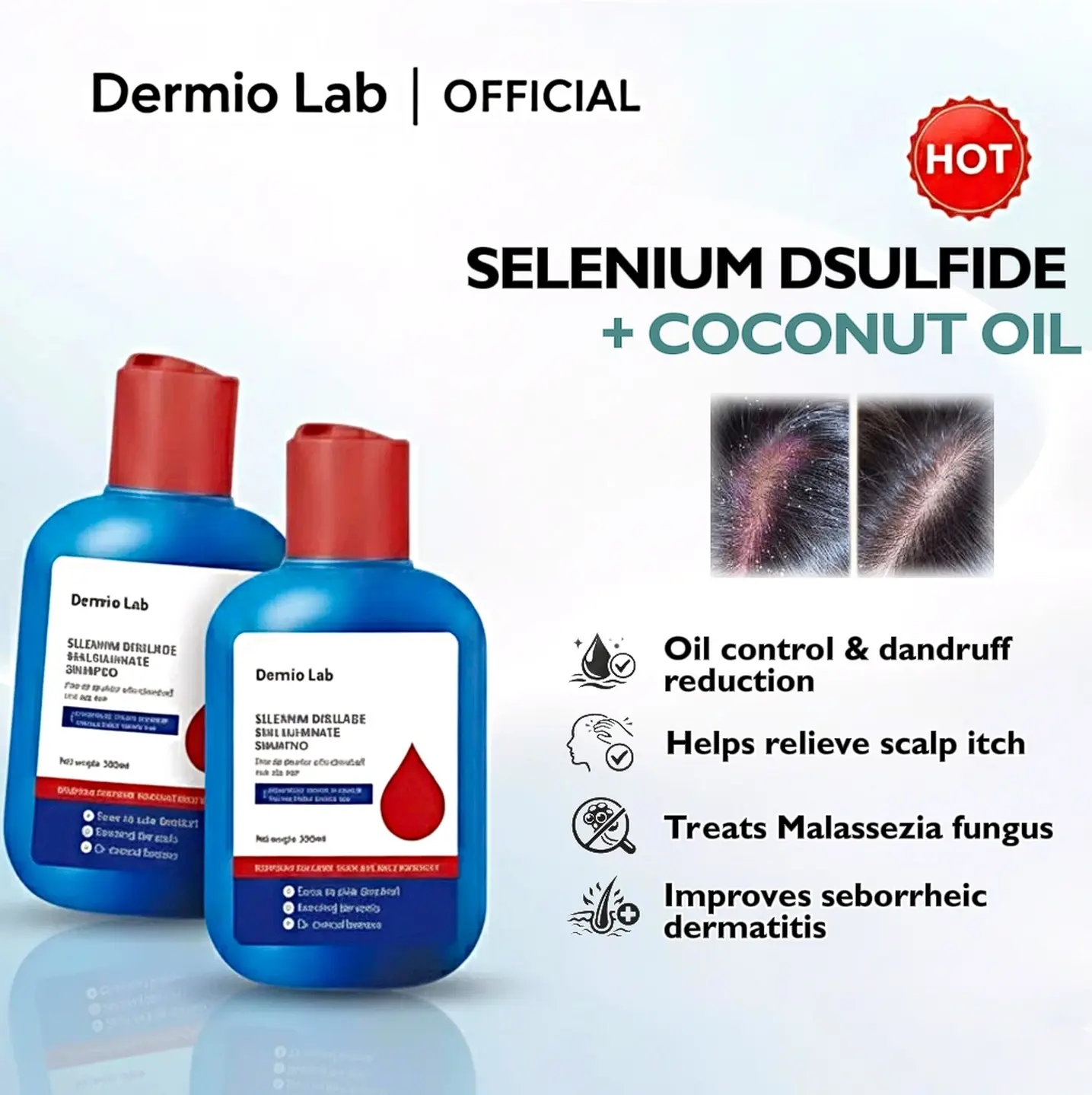 Soothing Coconut Oil & Selenium Disulfide Shampoo & Conditioner for Anti-Dandruff and Oil Control | Calming Itchy Scalp Relief, 300ML, Calming Shampoo, Coconut Oil Shampoo