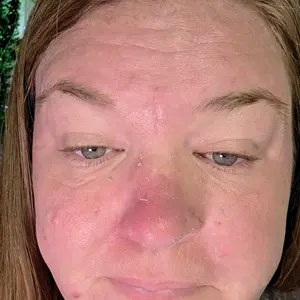 [Dr.Melaxin Official] Peel Shot Glow Rice Peeling Ampoule, Soft Exfoliating Face & Body Dead cell, Blackheads Remover for All Skin Types, 80ml Skincare Comfort ampoule