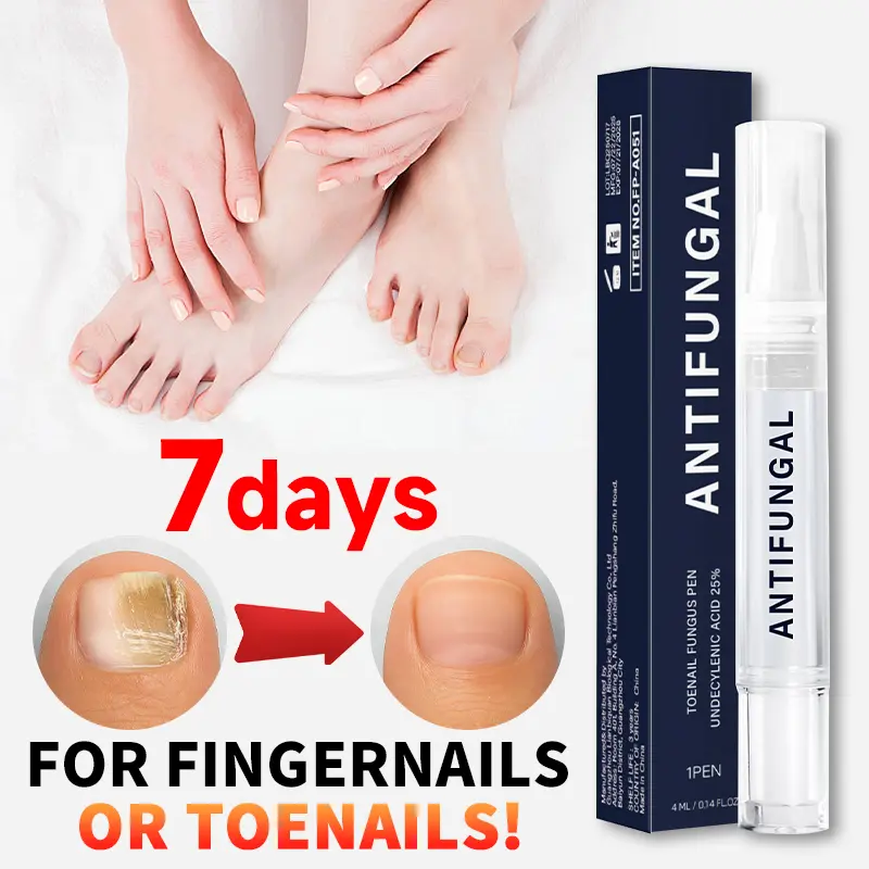 [special effects]Toenail Fungus Treatment ExtraStrengthAntifungal Solution for Toenail or Fingernail, TripleActionFormula for Remove Fungal, Repair and RenewalDamagedNails