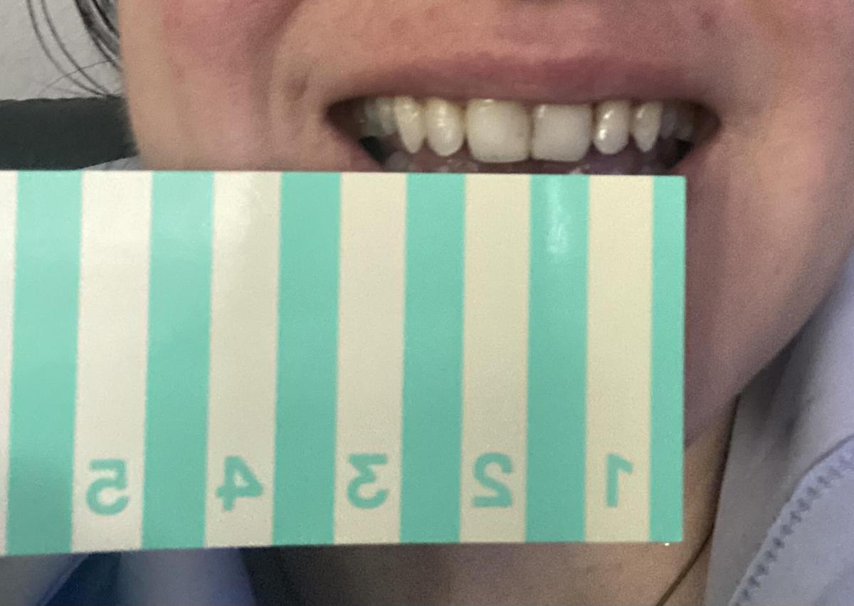 Item: 1 PACK -14 STRIPS