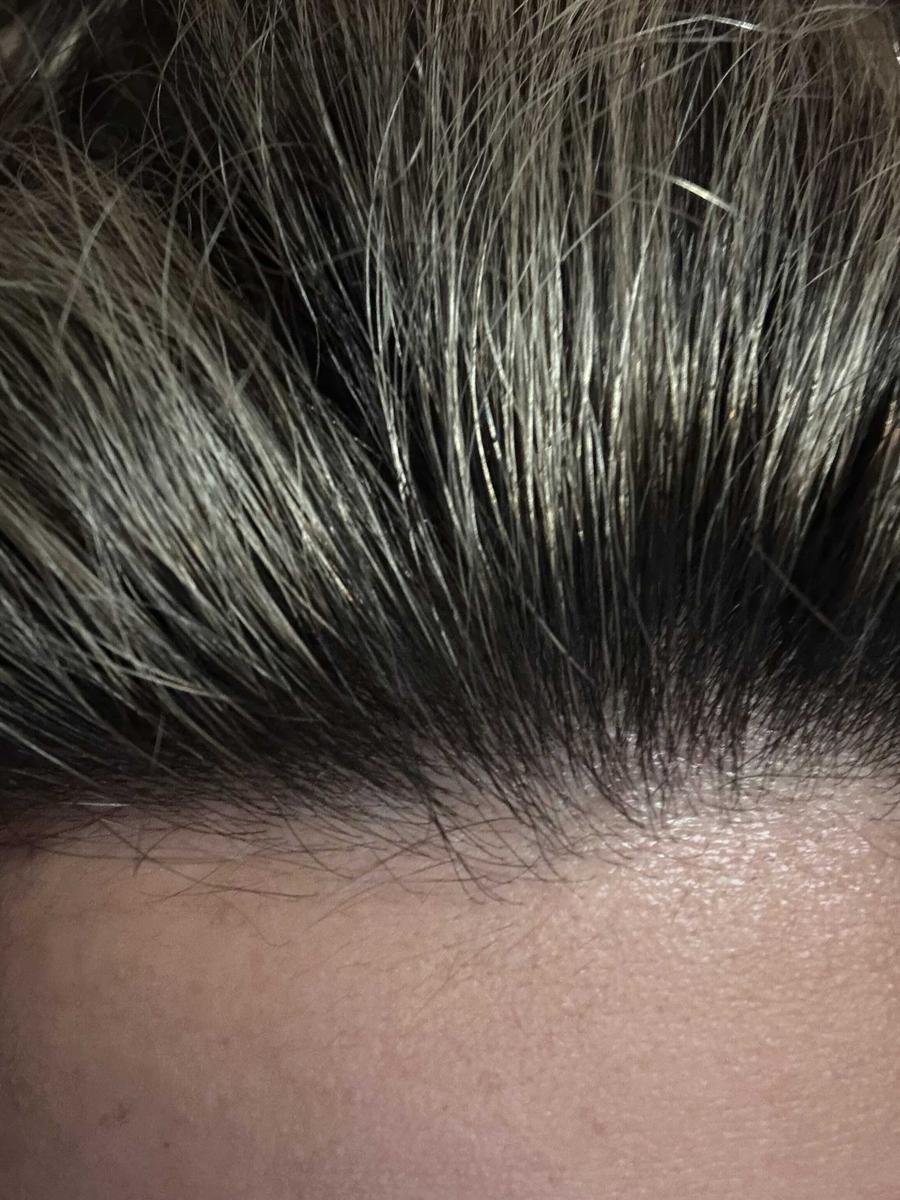 Item: Selenium Disulfide  Shampoo 300ML