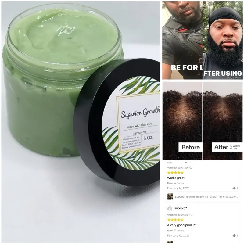 Superior growth grease, all natural hair grease,aloe Vera hair grease, hair  growth grease, hair moisturizer, hair growth, thick hair Organic  Anti-dandruff, Haircare - TikTok Shop
