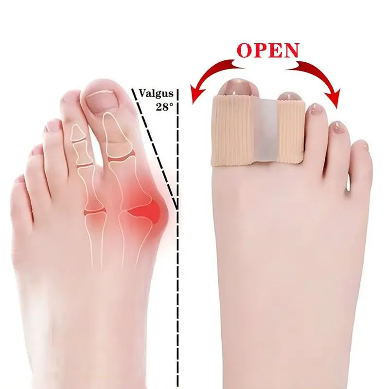 Silicone Toe Separators for Bunion Relief-springtok ,All-DayComfort for Walking, Running, Hiking | Bunion Corrector &Toe Sleeves Healthcare