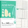 TKTK 443-Count Fragrance-Free Hydrocolloid Pimple Patches Bulk Pack - Multiple Sizes (Dots, Strips, Contoured), for Face Cheeks, Forehead, Chin Blemishes, Teens, Adults, All Skin Types, Self Care & Acne Clearing Products Foreheadstickers Chinblemishes
