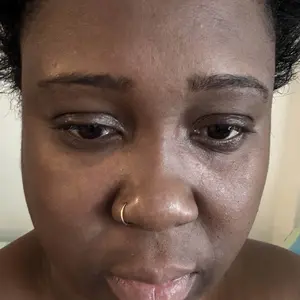 Product Review of [Dr.Melaxin Official] Peel Shot Glow Rice Ampoule Duo - Serums for Brightening, Exfoliating, and Moisturizing - Suitable for All Skin Types from L**r