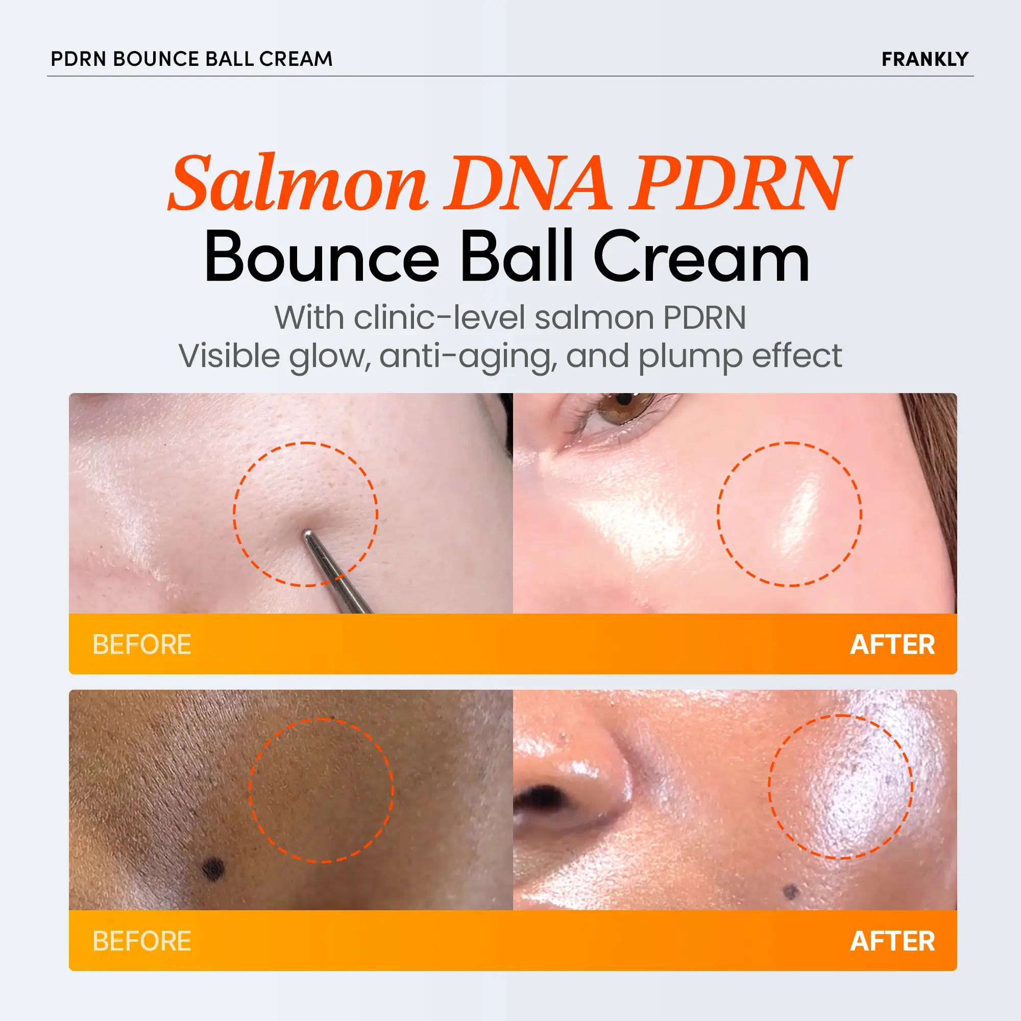 FRANKLY] Salmon PDRN Bounce Ball Cream – 99% Pure Salmon DNA