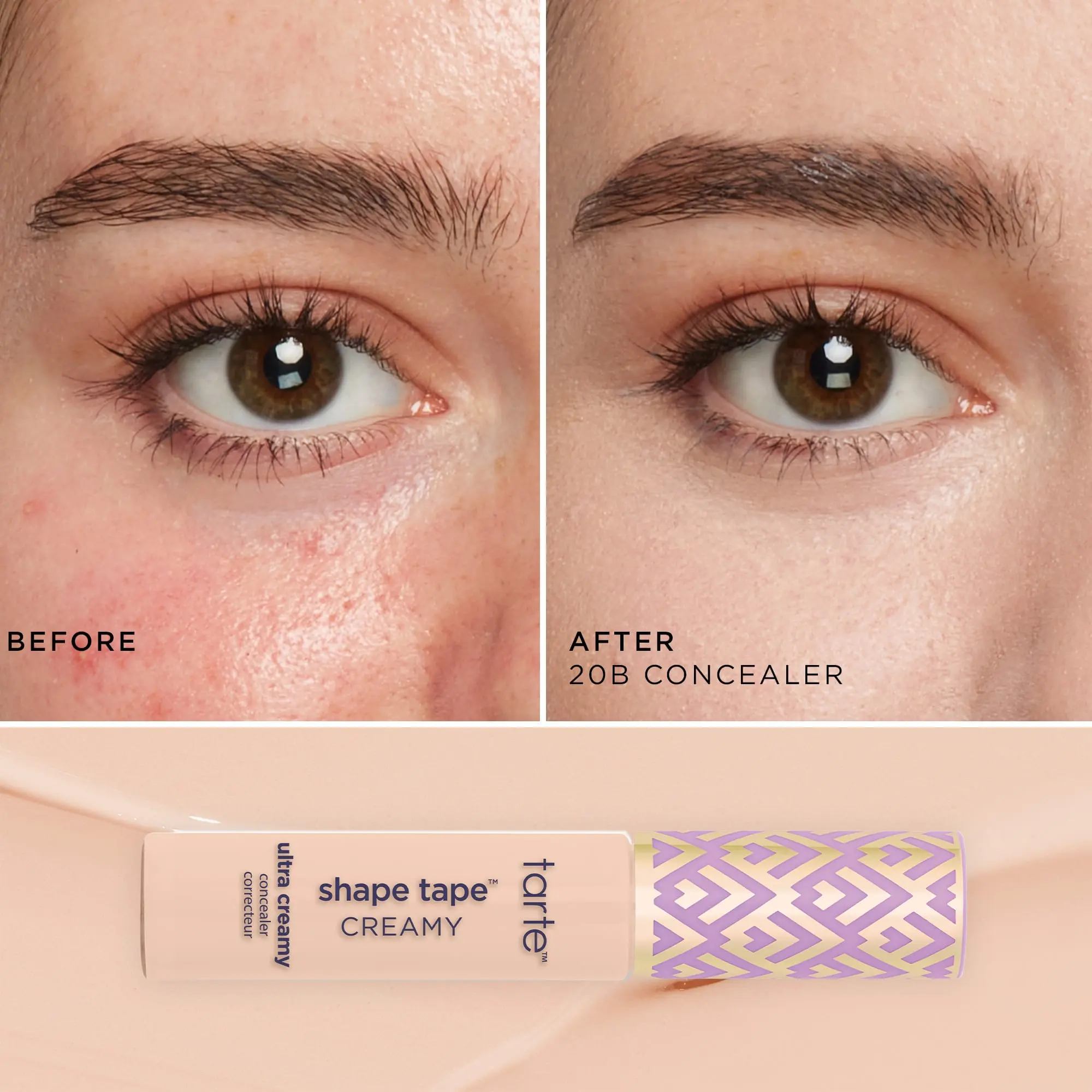 20B light (light skin with cool