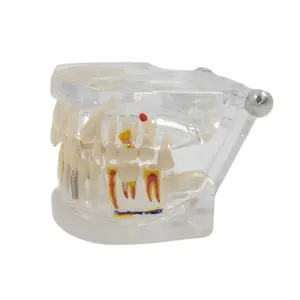 Transparent Permanent Teeth Model