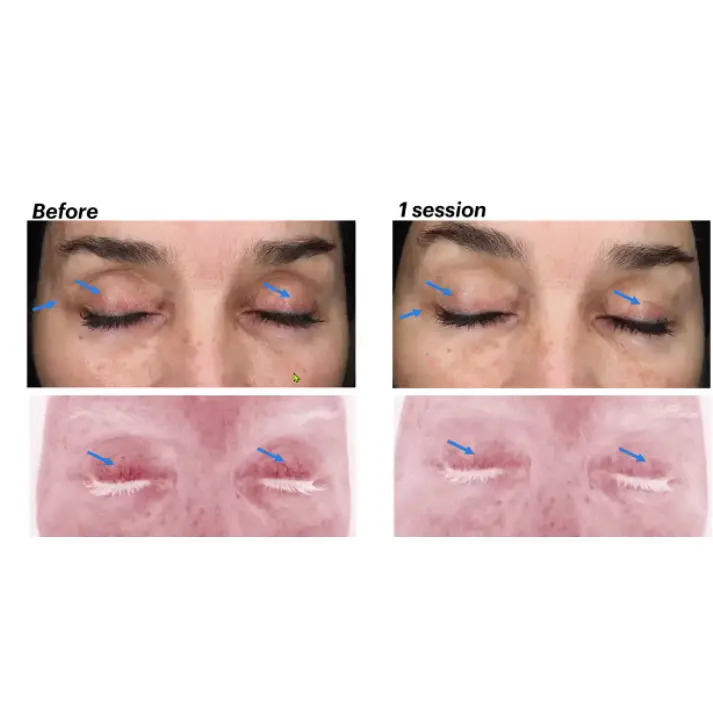 Eye Luv Session