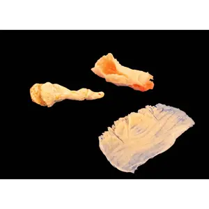 Silicone Prosthetic Finger Degloving Pack