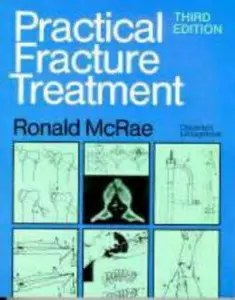 USED Book - Practical Fracture Treatment by Ronald McRae FRCS(Eng  Glas)  FChS(Hon)  AIMBI  Fellow of the British Orthopaedic Association (Paperback) - english